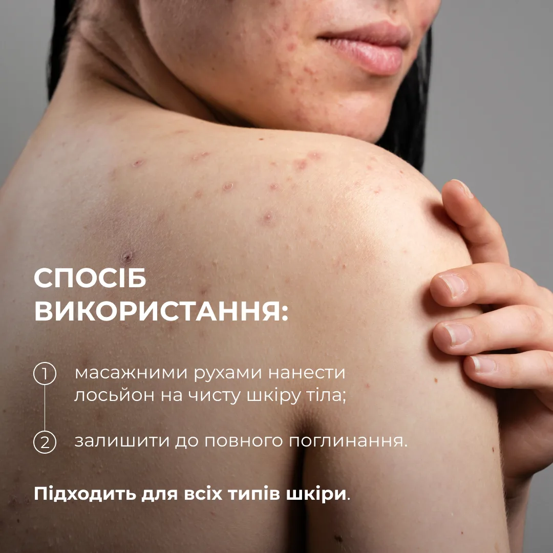 Комплекс проти висипань на тілі та глибокого живлення Hillary Body Acne & Deep Nourishment Complex