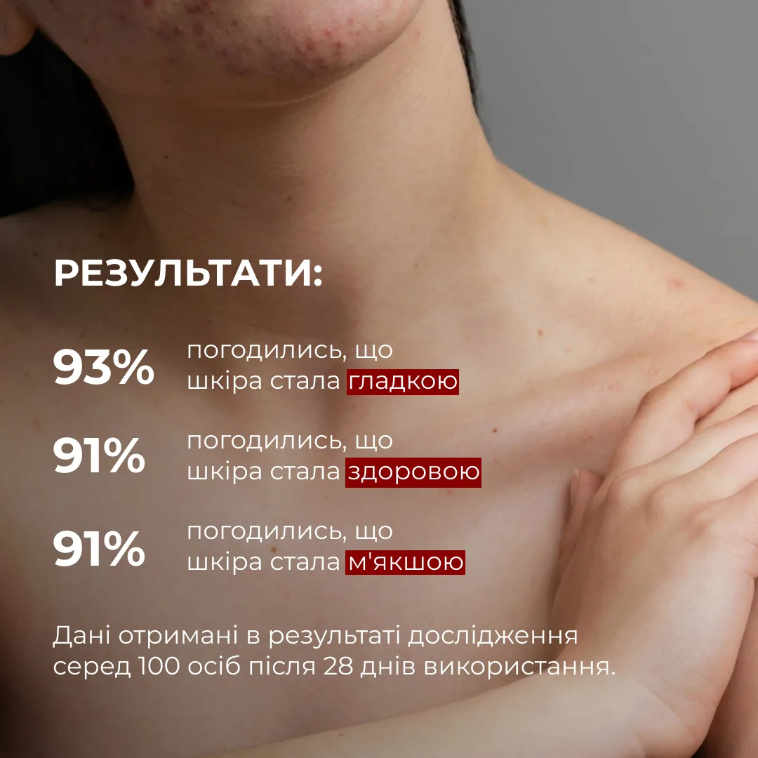 Комплекс для тіла проти акне з саліциловою кислотою Hillary Anti-Acne Body Care Complex with Salicylic Acid
