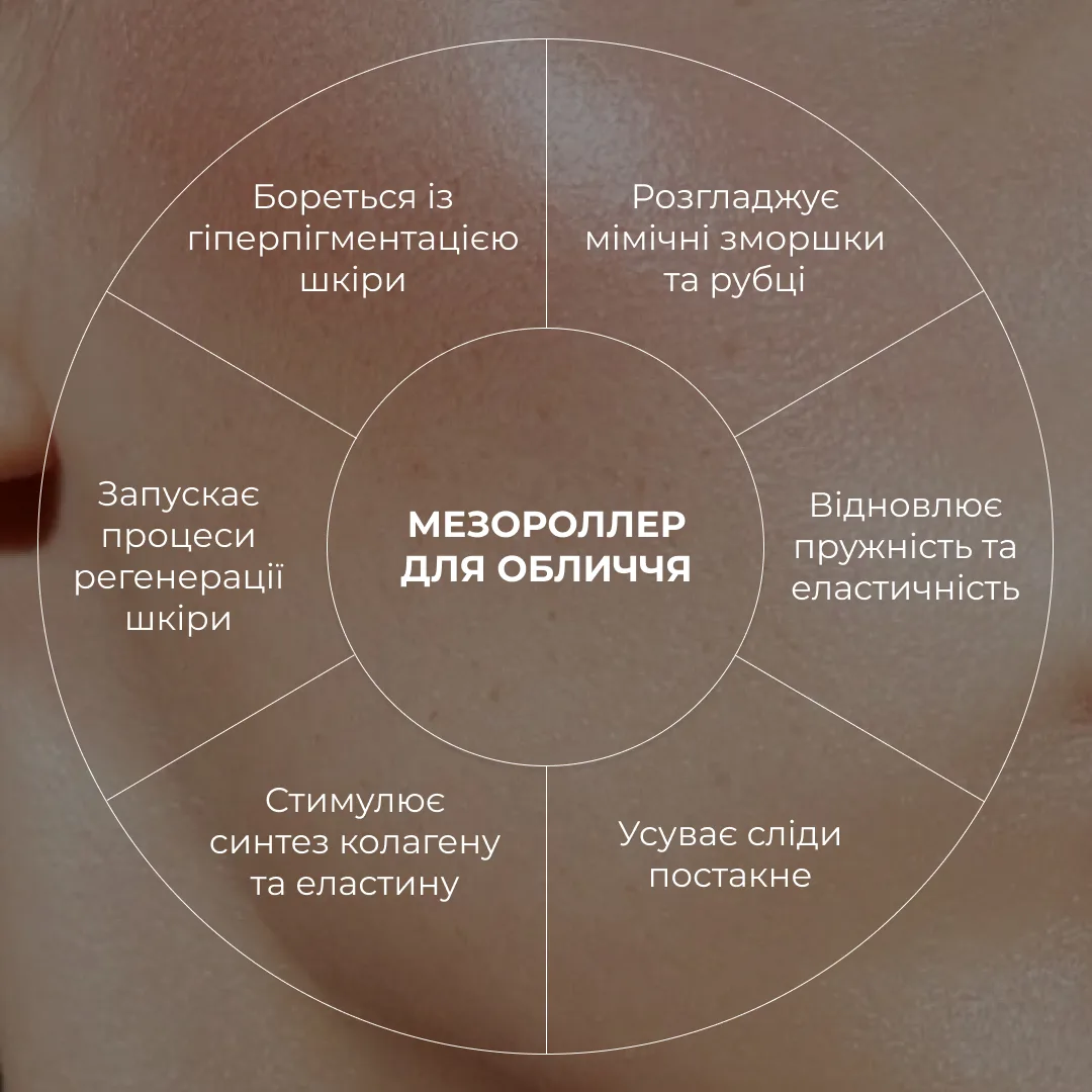 Гіалуронова сироватка Hillary Smart Hyaluronic, 30 мл + Мезороллер для обличчя Hillary