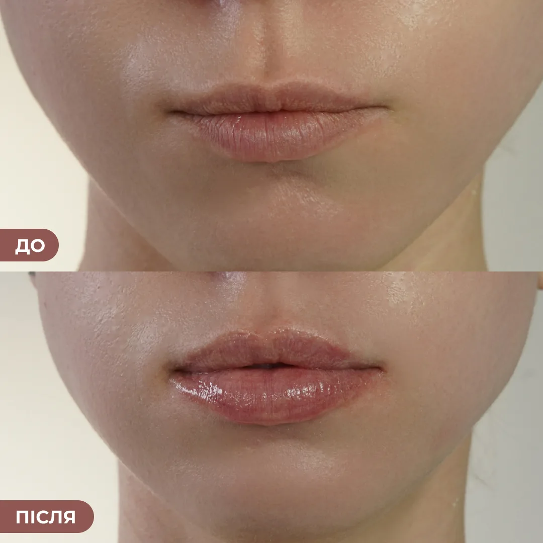 Бальзам-блиск для губ Hillary Elegance Rosé Elixir, 10 мл