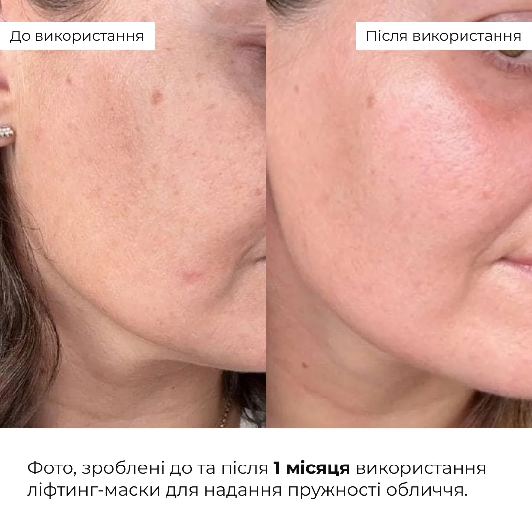 Набір для ліфтингу та відновлення пружності шкіри обличчя Hillary Face Lifting & Firming Set