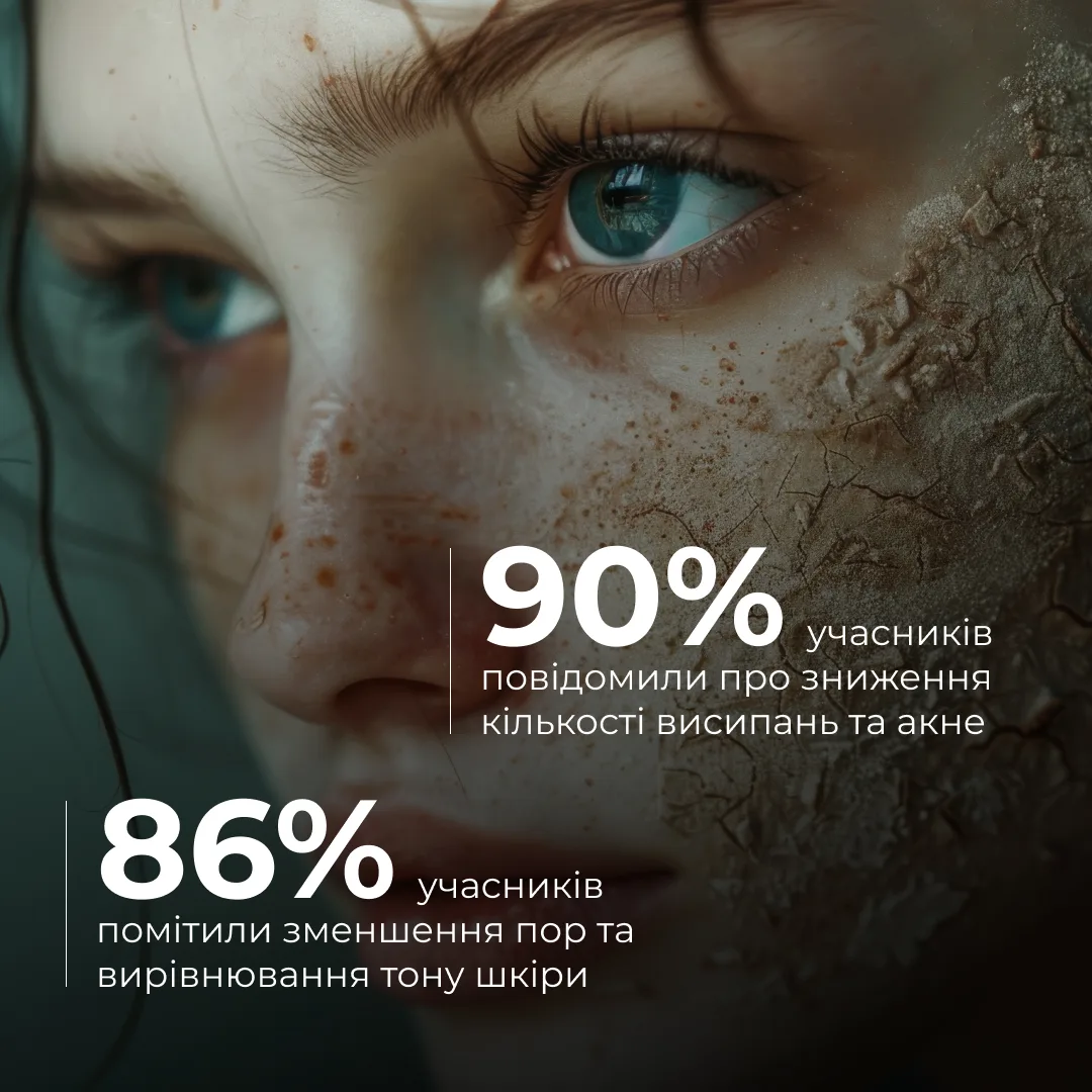 Набір для очищення та боротьби з акне Hillary Anti-Acne & Detox Skin Set