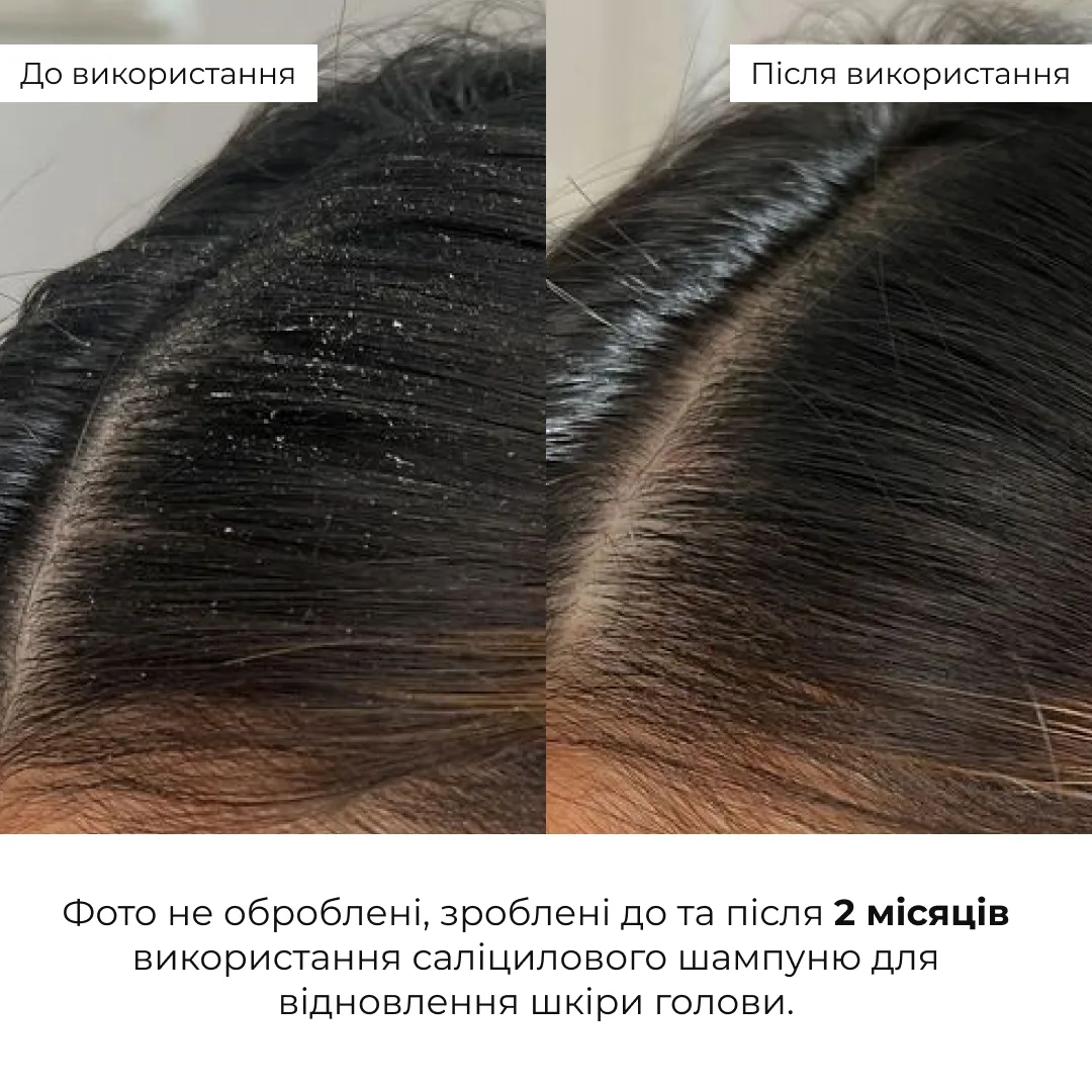 Комплект для глибокого очищення та відновлення волосся і шкіри голови Hillary Deep Cleanse & Hair Restoration