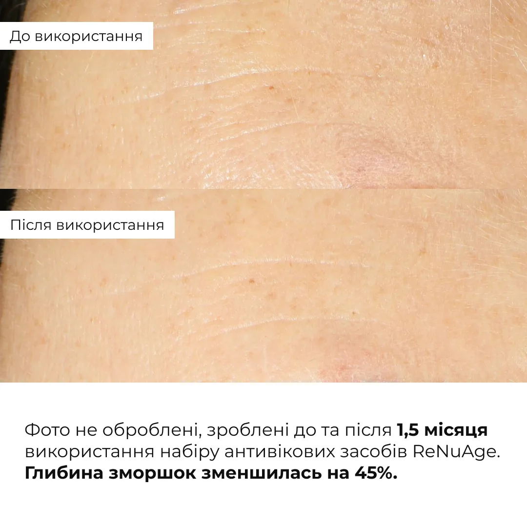 Комплексна антивікова система ReNuAge Total Anti-Aging System