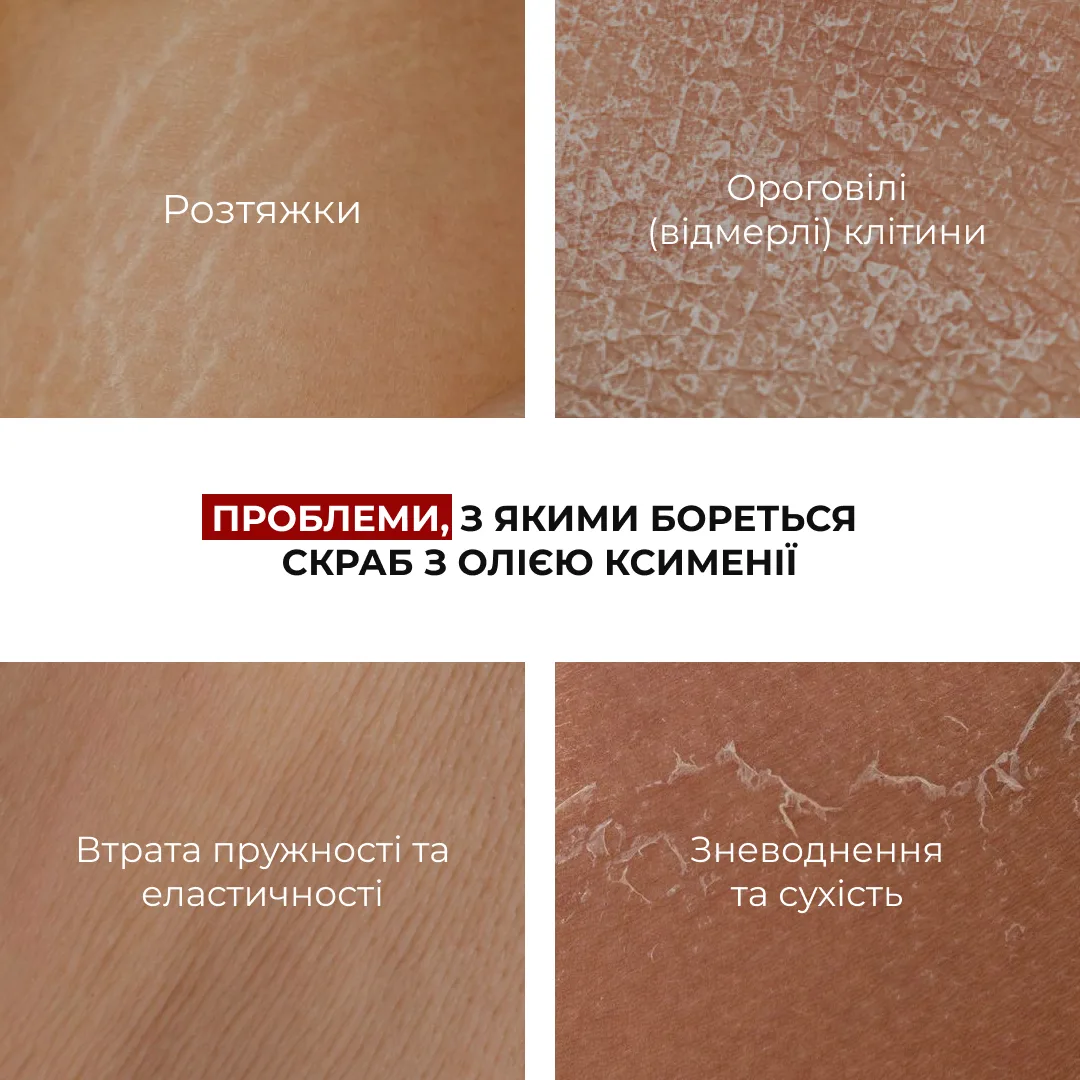 Cкраб з олією ксименії для попередження появи розтяжок Hillary Ximenia Radiance Body Scrub, 200 г