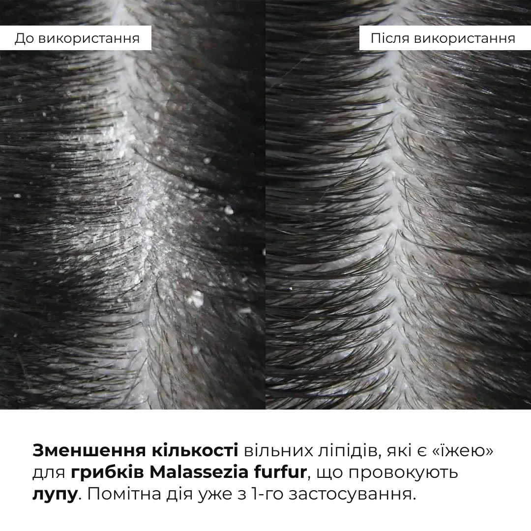 Комплекс для всіх типів волосся Hillary Perfect Care Hair Nori