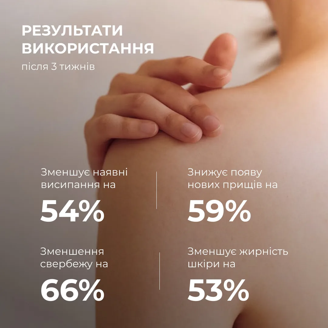 Очищувальний гель для тіла з саліциловою кислотою Hillary Anti-Acne Salicylic Body Wash, 200 мл