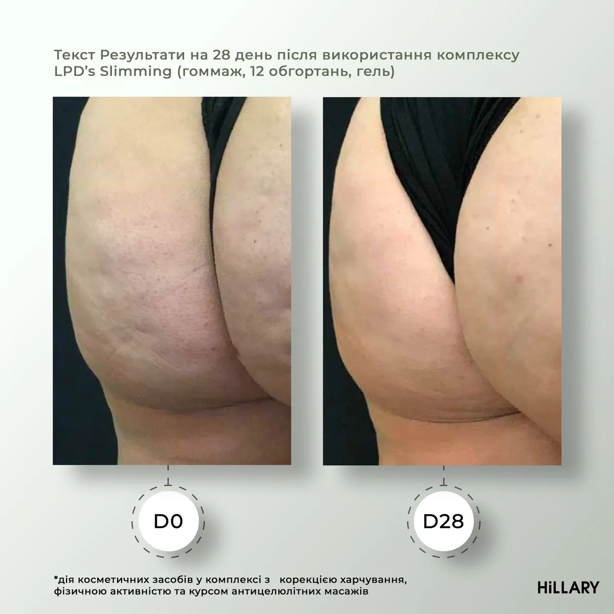 Рідина для антицелюлітних ліпосомальних обгортань Hillary Anti-cellulite Bandage LPD'S Slimming Fluid, 500 мл