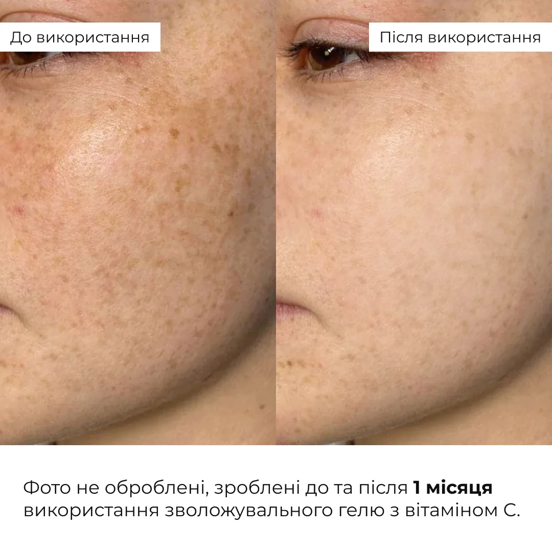 Комплекс для лифтинга и восстановления упругости кожи лица и шеи Hillary Face & Neck Firming & Lifting Compl