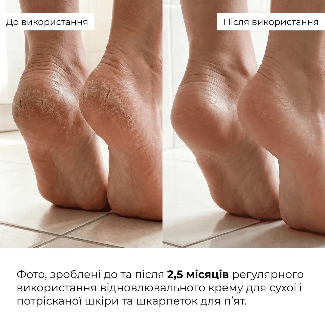 Комплекс для пом’якшення та відновлення потрісканих п’ят Hillary Cracked Heel Softening & Repair Complex