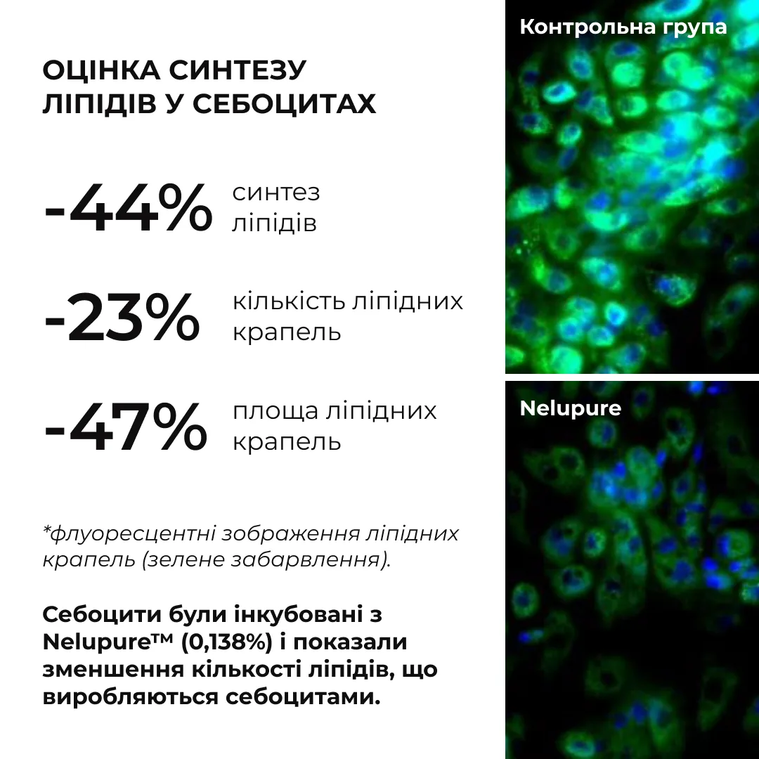 Набір себорегулюючого догляду для жирної та проблемної шкіри обличчя Hillary for oily and problematic skin
