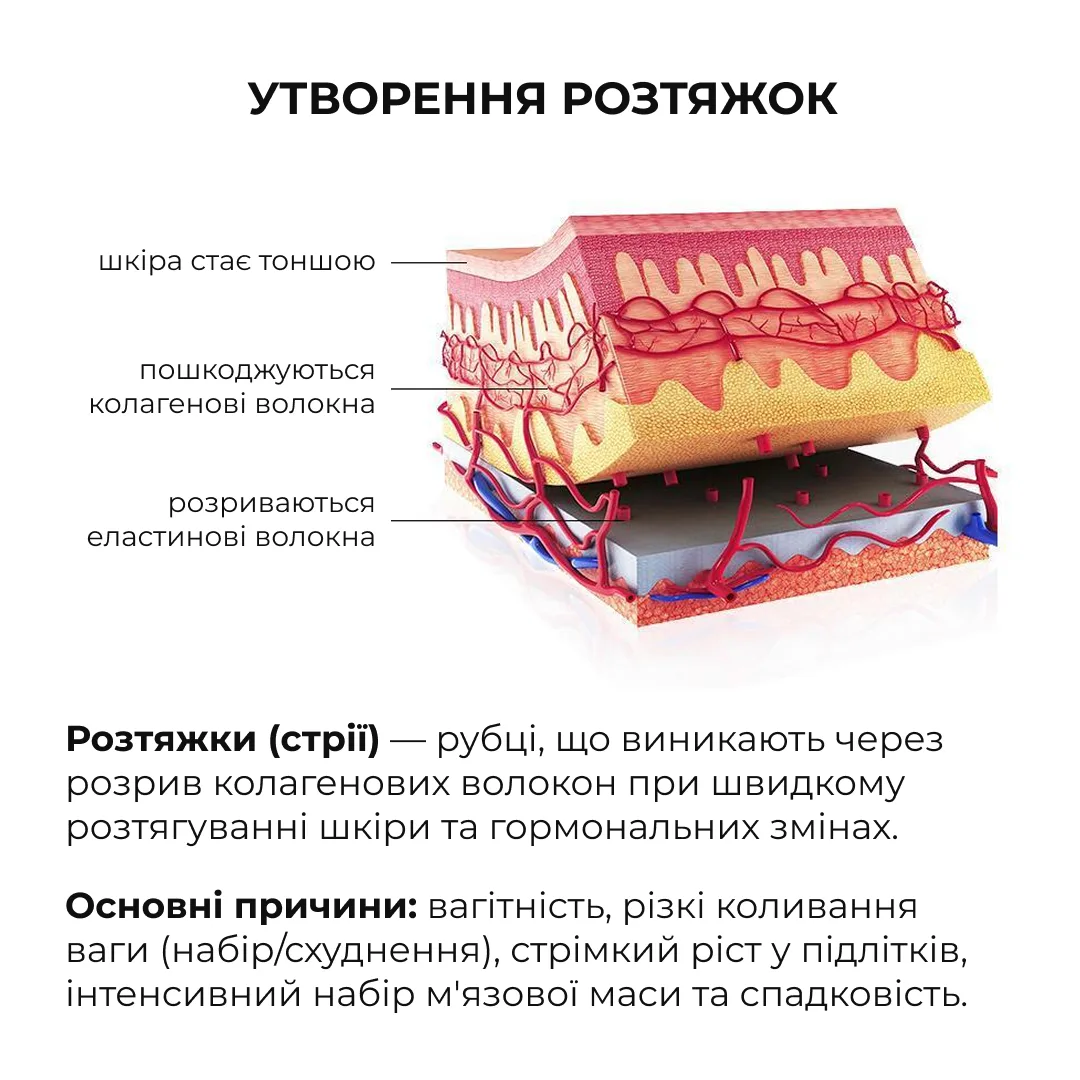 Набір проти розтяжок та для покращення пружності шкіри Hillary Stretch Mark & Skin Firming Set