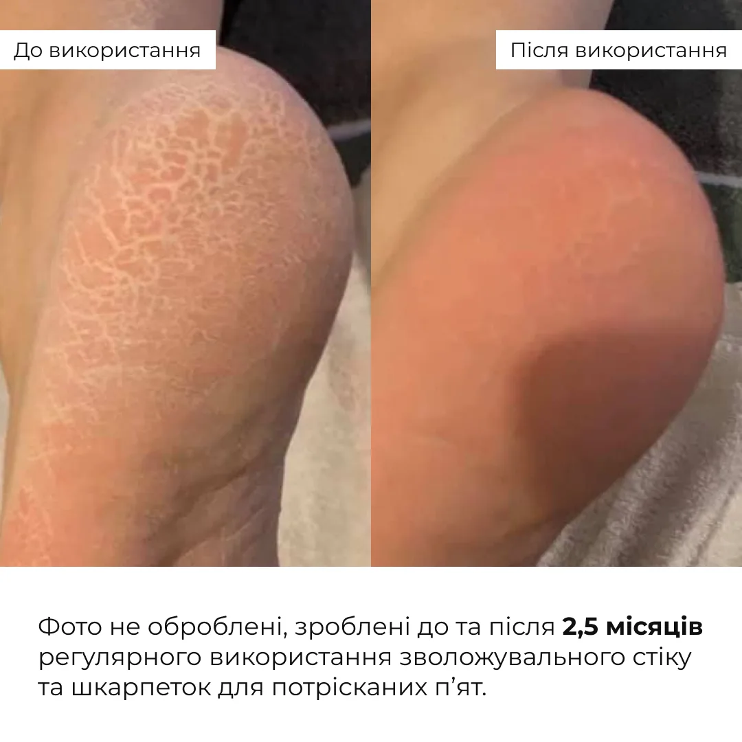 Зволожувальні шкарпетки для п’ят Hillary HydraHeel Soft Socks