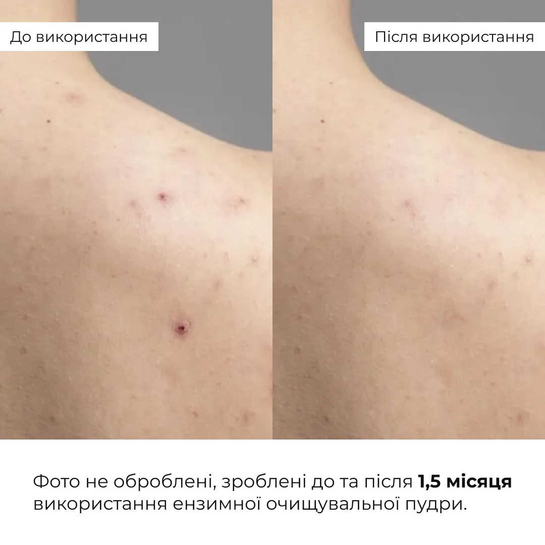 Набір для глибокого очищення та зняття набряків Hillary Enzyme Cleanse & Anti-Puffiness Complex
