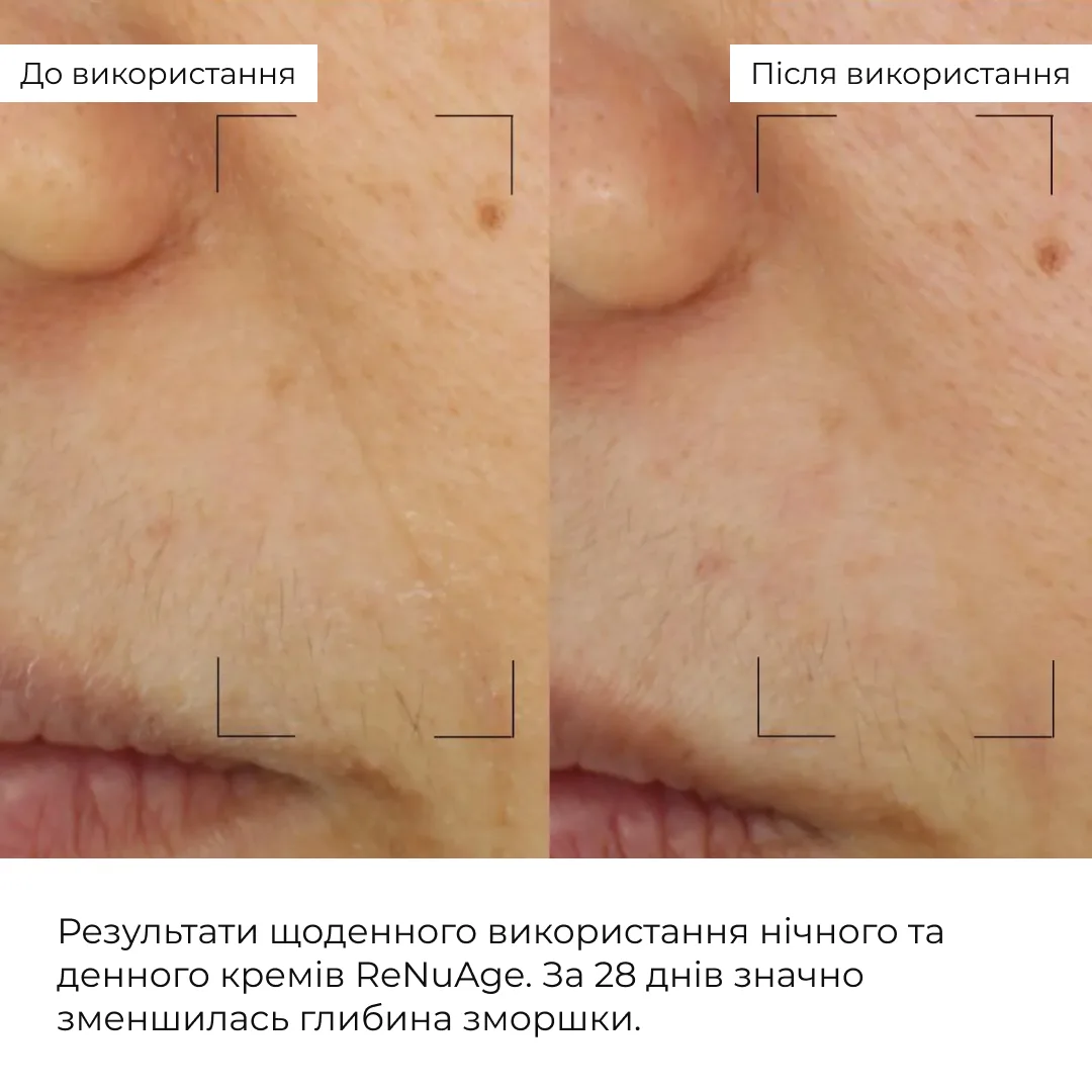Набор антивозрастных кремов ReNuAge для увлажнения и восстановления кожи коллагеновый крем для лица.