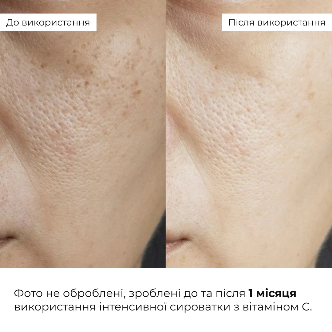 Набір вирівнювання тону з вітаміном С з колагеновою гранолою Hillary Vitamin C Radiance & Even Tone Kit with C