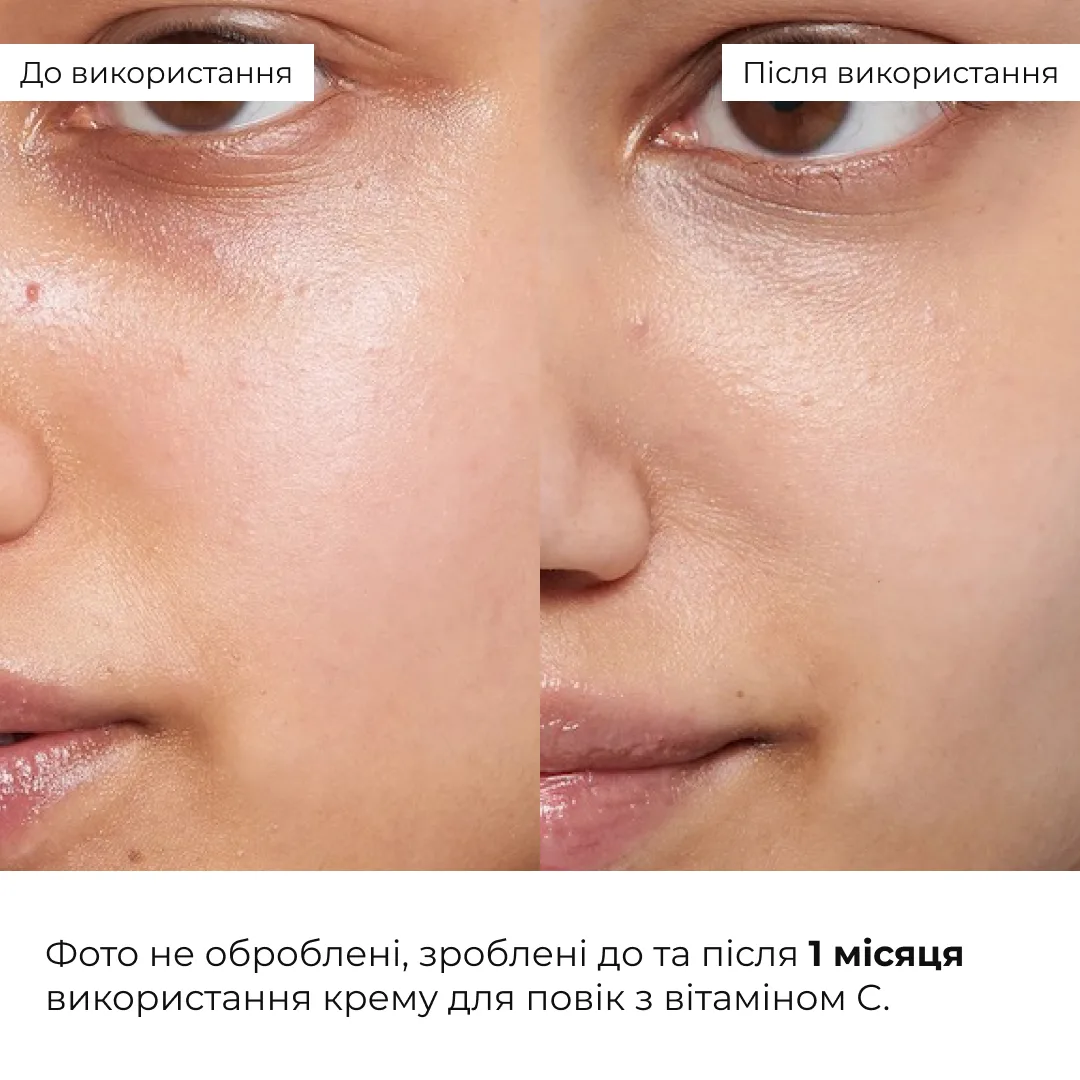 Набір вирівнювання тону з вітаміном С з колагеновою гранолою Hillary Vitamin C Radiance & Even Tone Kit with C