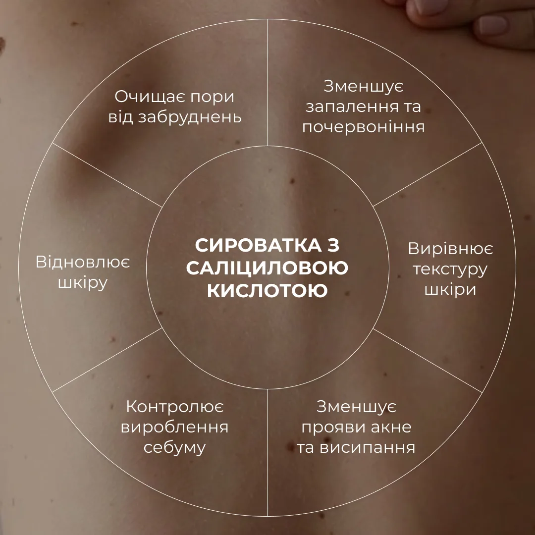 Комплект для боротьби з акне на тілі з саліциловою кислотою Hillary Salicylic Body Acne Treatment Set
