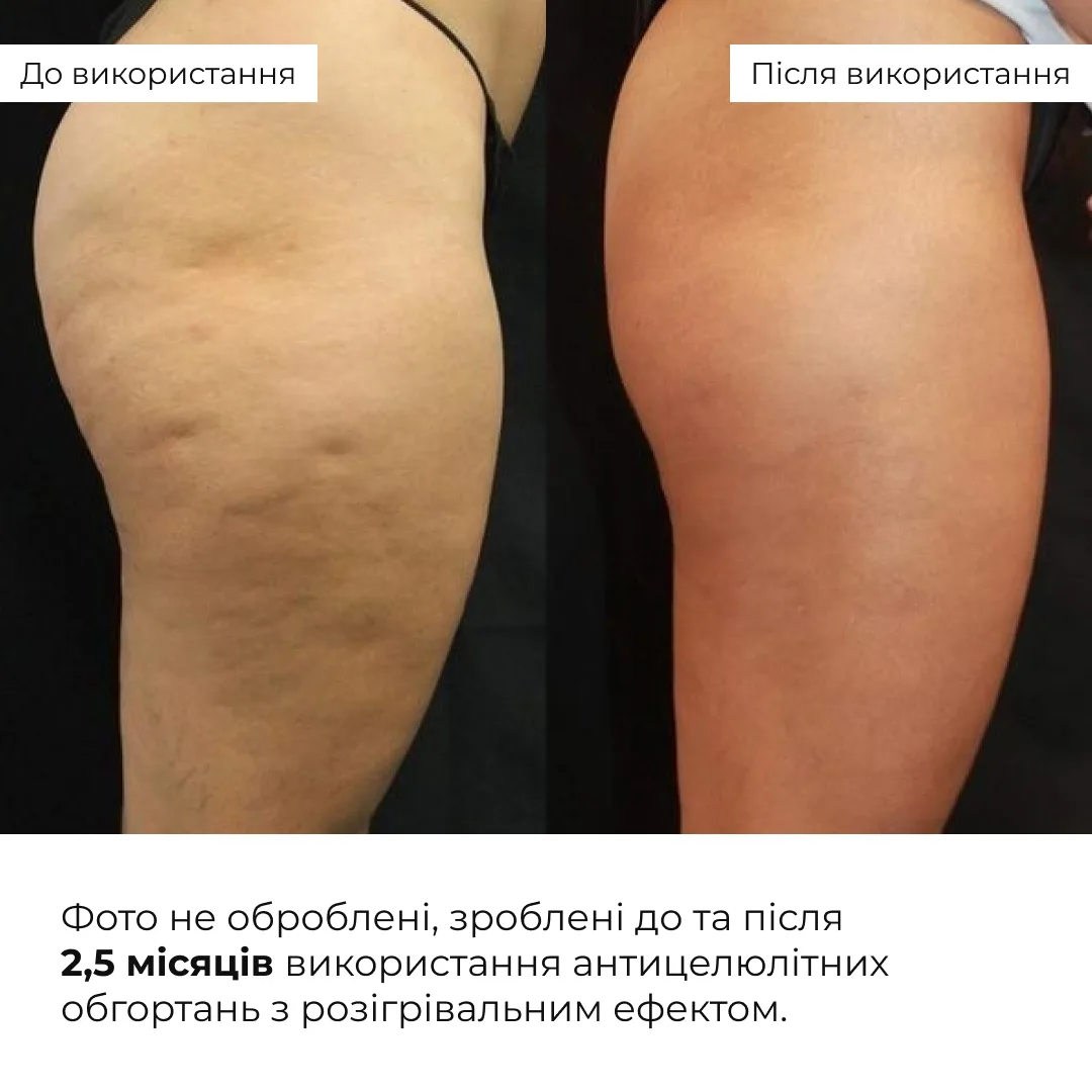 Комплекс розігріваючих антицелюлітних обгортань для тіла Hillary Anti-Cellulite Pro (10 уп,)