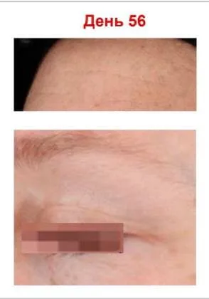 Антиоксидантна пептидна сироватка з вітаміном С Hillary Antioxidant Age Reverse Serum 30+, 30 мл