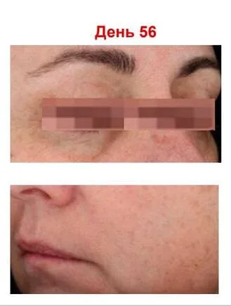 Антиоксидантна пептидна сироватка з вітаміном С Hillary Antioxidant Age Reverse Serum 30+, 30 мл