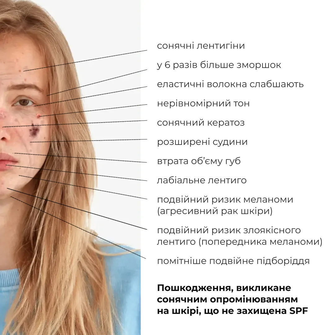 Набір проти жирності, запалень і пігментних плям SPF30+ Hillary Anti-Blemish & Oil Control Set with SPF30+ Pro