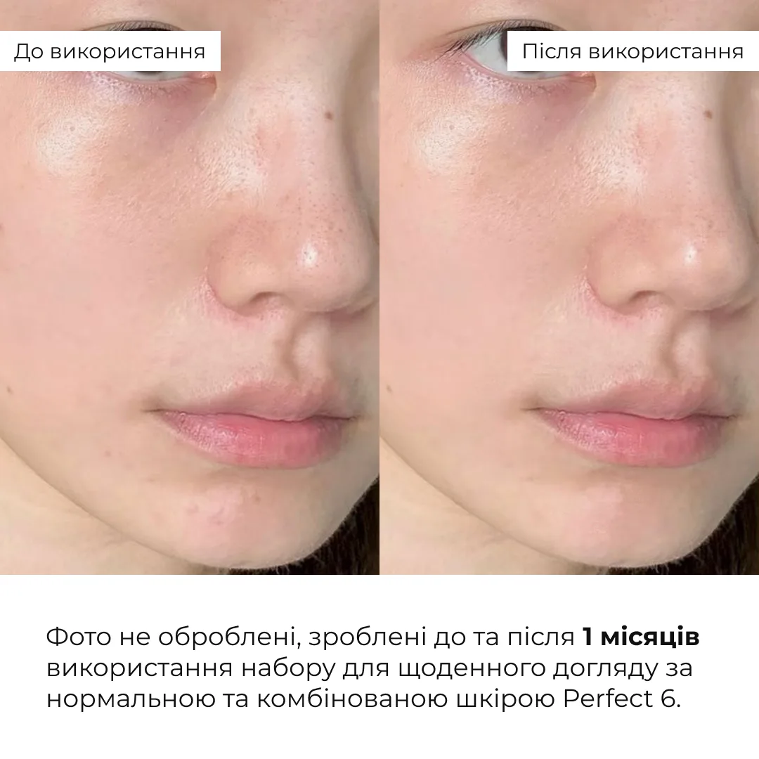 Набір для щоденного догляду за нормальною та комбінованою шкірою Hillary Perfect 6