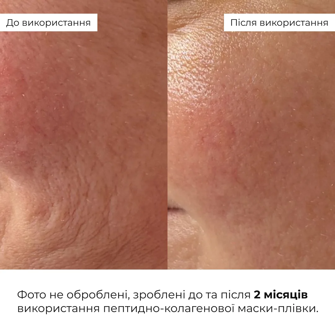 Набір для відновлення пружності шкіри обличчя Hillary Skin Firmness Recovery Set