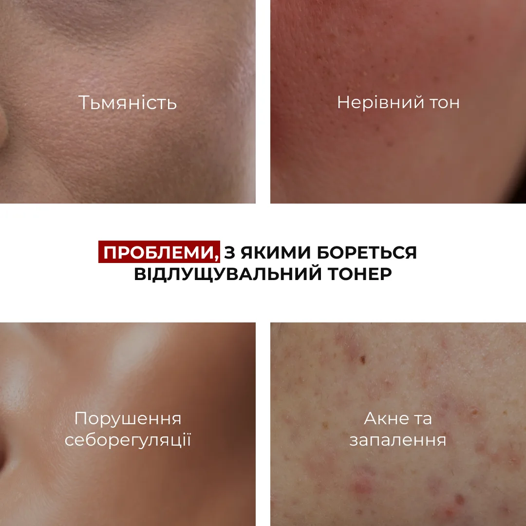 Набор кислот Хиллари для сухой кожи: увлажнение, отшелушивание, нормализация текстуры кожи.