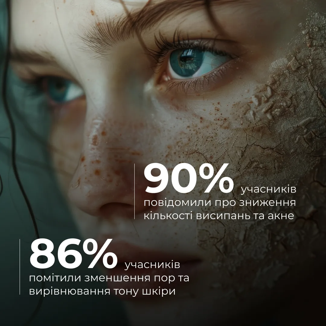 Набір проти висипань, набряків і тьмяних губ Hillary Anti-Acne, Anti-Puffiness & Lip Glow Set