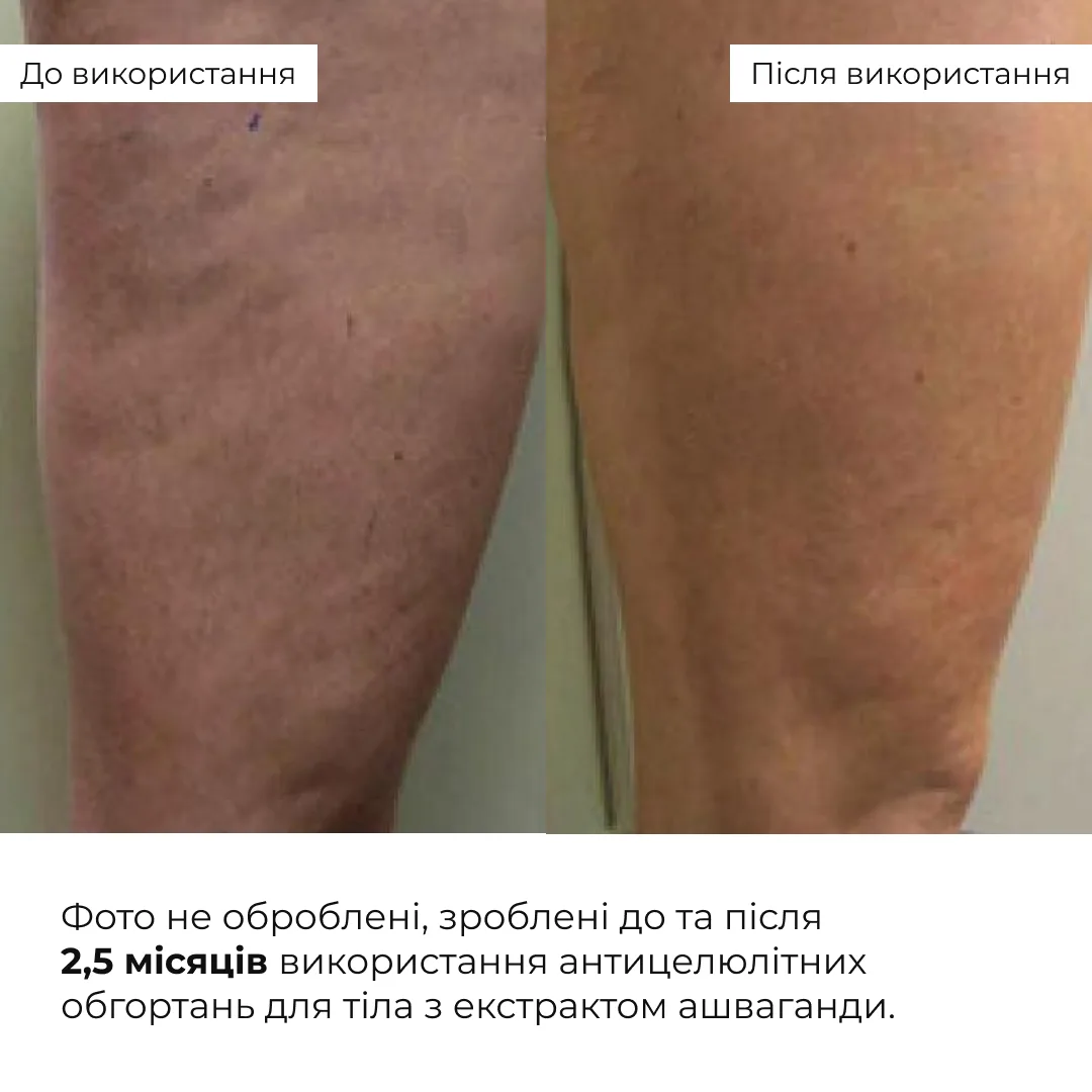 Комплекс антицелюлітних моделюючих обгортань з екстрактом ашваганди Hillary Ashwagandha Hot Slim (10 уп.)