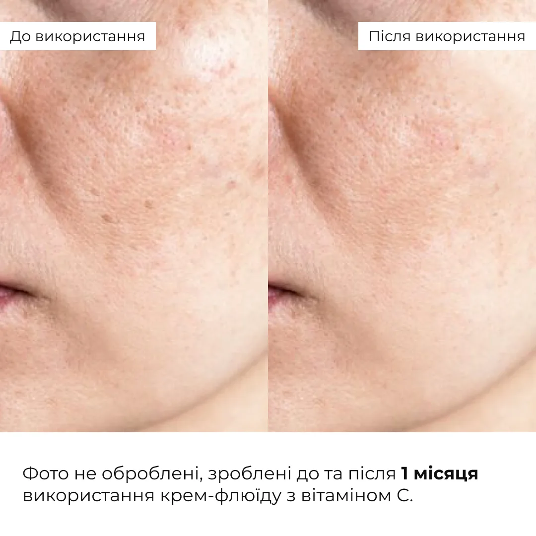 Комплекс для восстановления тонуса и защиты от пигментации SPF 30 Hillary набор для лица увлажнение защита от солнца