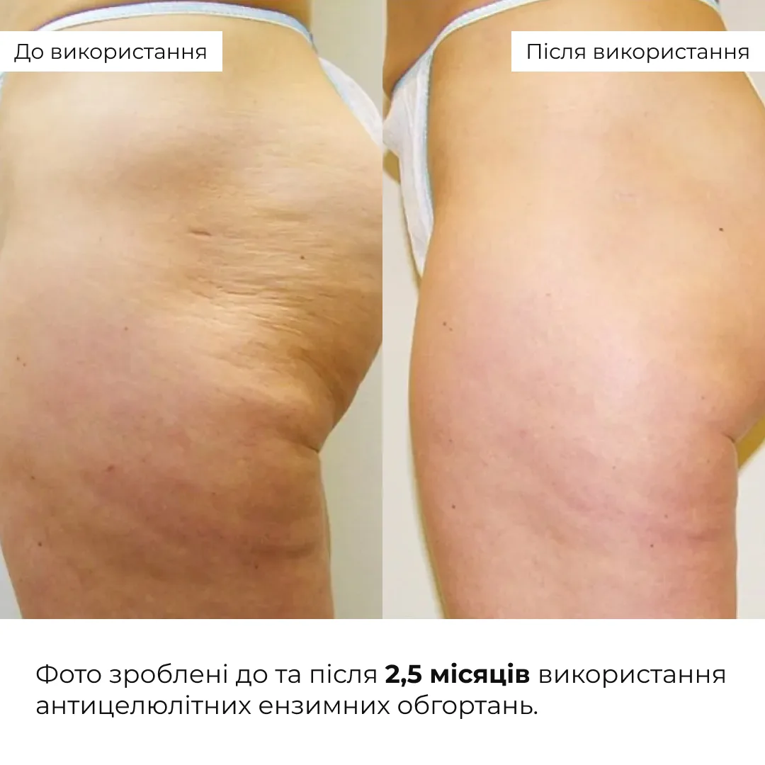 Антицелюлітні ензимні обгортання Hillary Anti-cellulite Bandage Zymo Cell