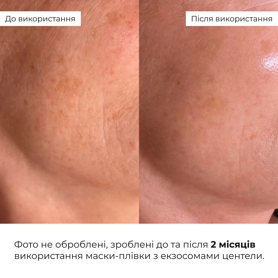 Комплект проти тьмяності шкіри обличчя та сухості губ Hillary Set Against Dull Skin and Dry Lips