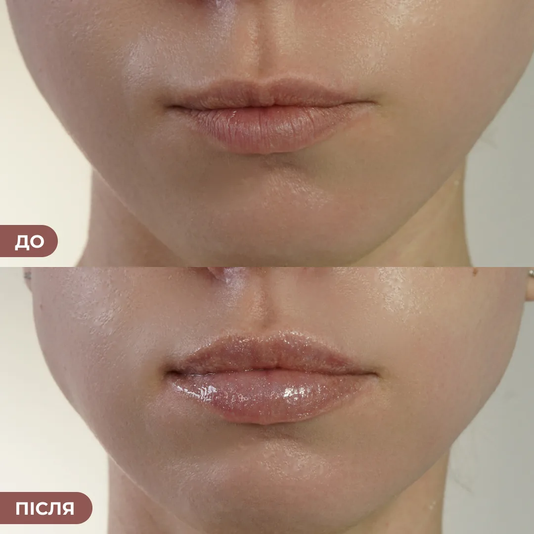 Комплект проти тьмяності шкіри обличчя та сухості губ Hillary Set Against Dull Skin and Dry Lips