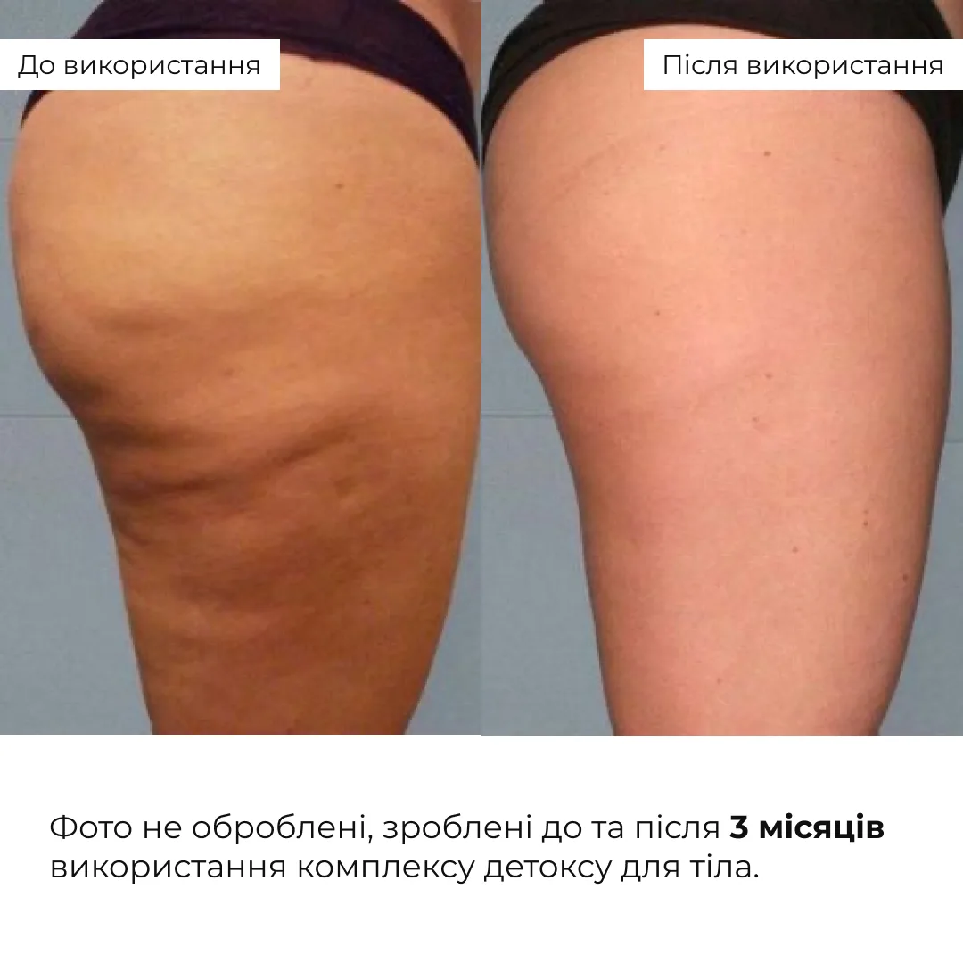 Комплекс детоксу для тіла Hillary Body Detox Complex