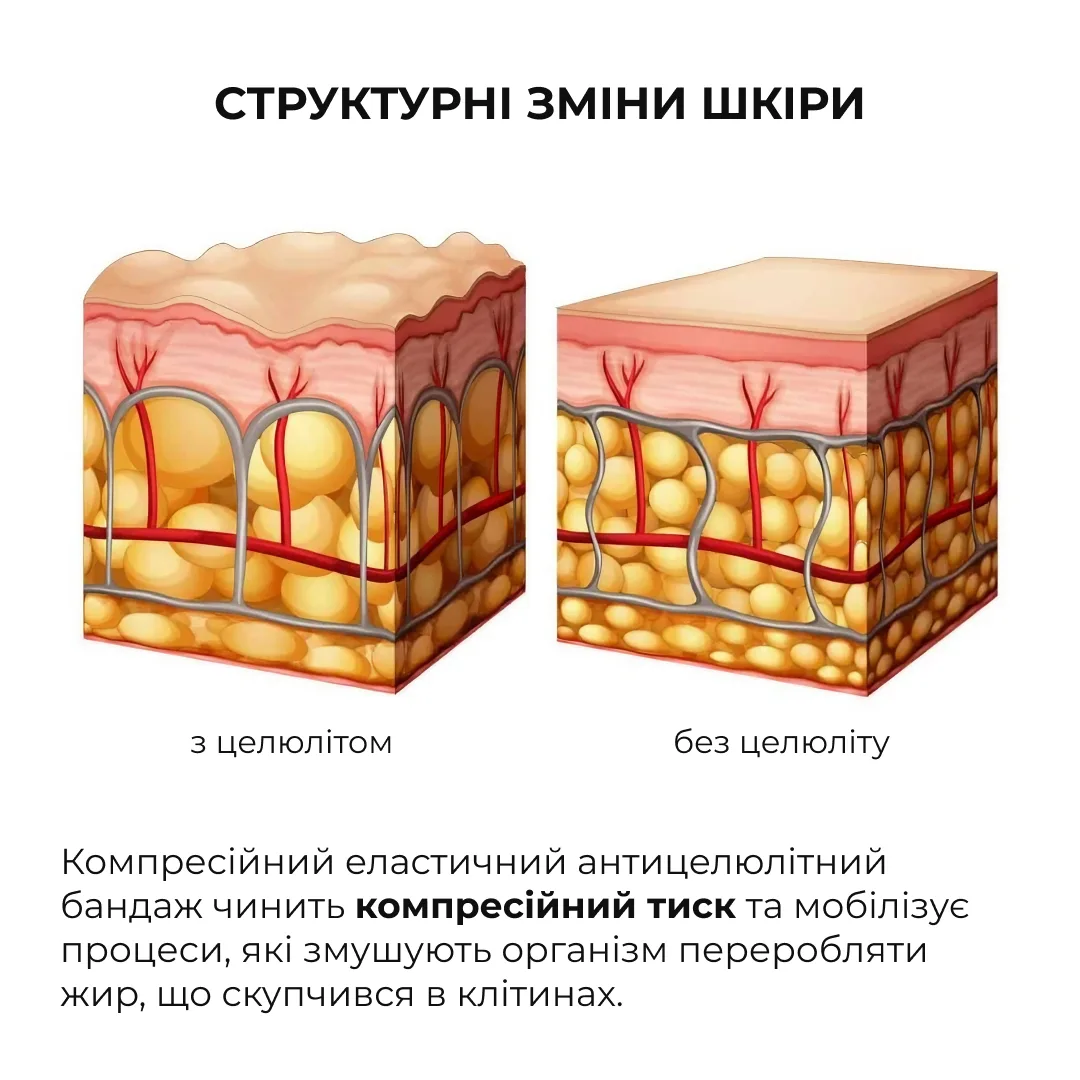 Антицелюлітні обгортання з олією ксименії Hillary Anti-cellulite Bandage African Ximenia