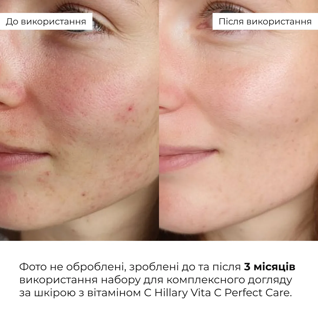 Набір для комплексного догляду за шкірою з вітаміном С Hillary Vitа С Perfect Care
