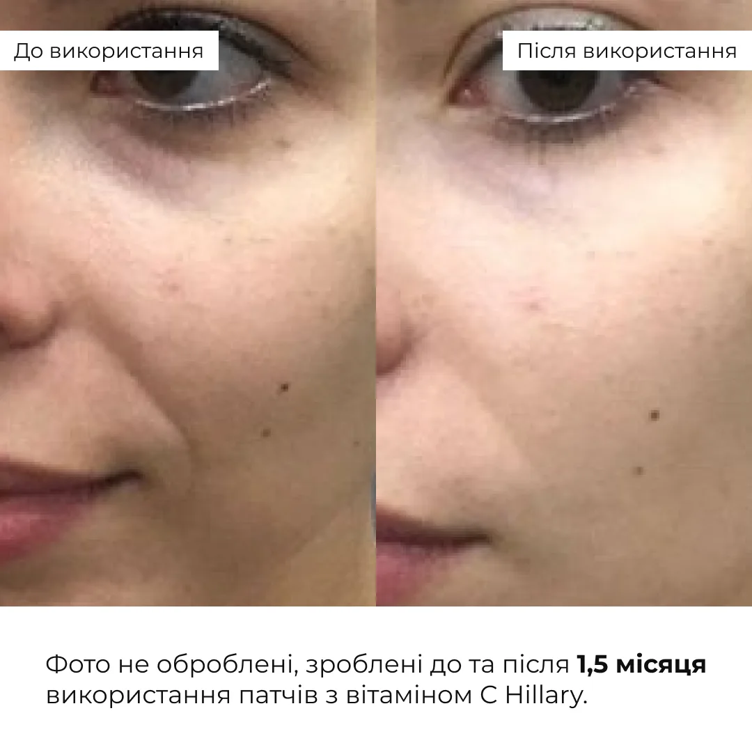Набір для комплексного догляду за шкірою з вітаміном С Hillary Vitа С Perfect Care