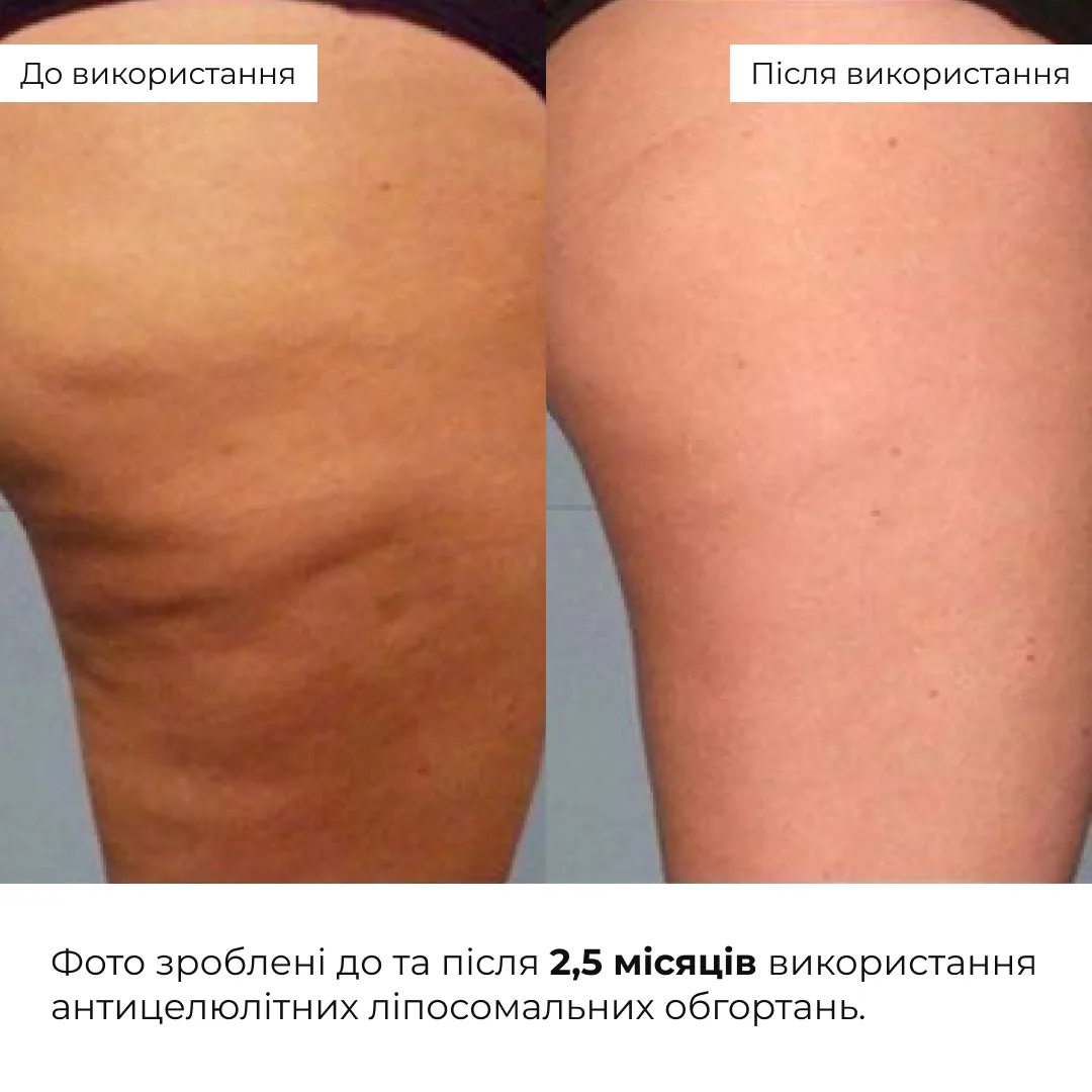 Комплекс Антицелюлітних ліпосомальних обгортань Hillary Anti-cellulite Bandage LPD'S Slimming (10 уп,)