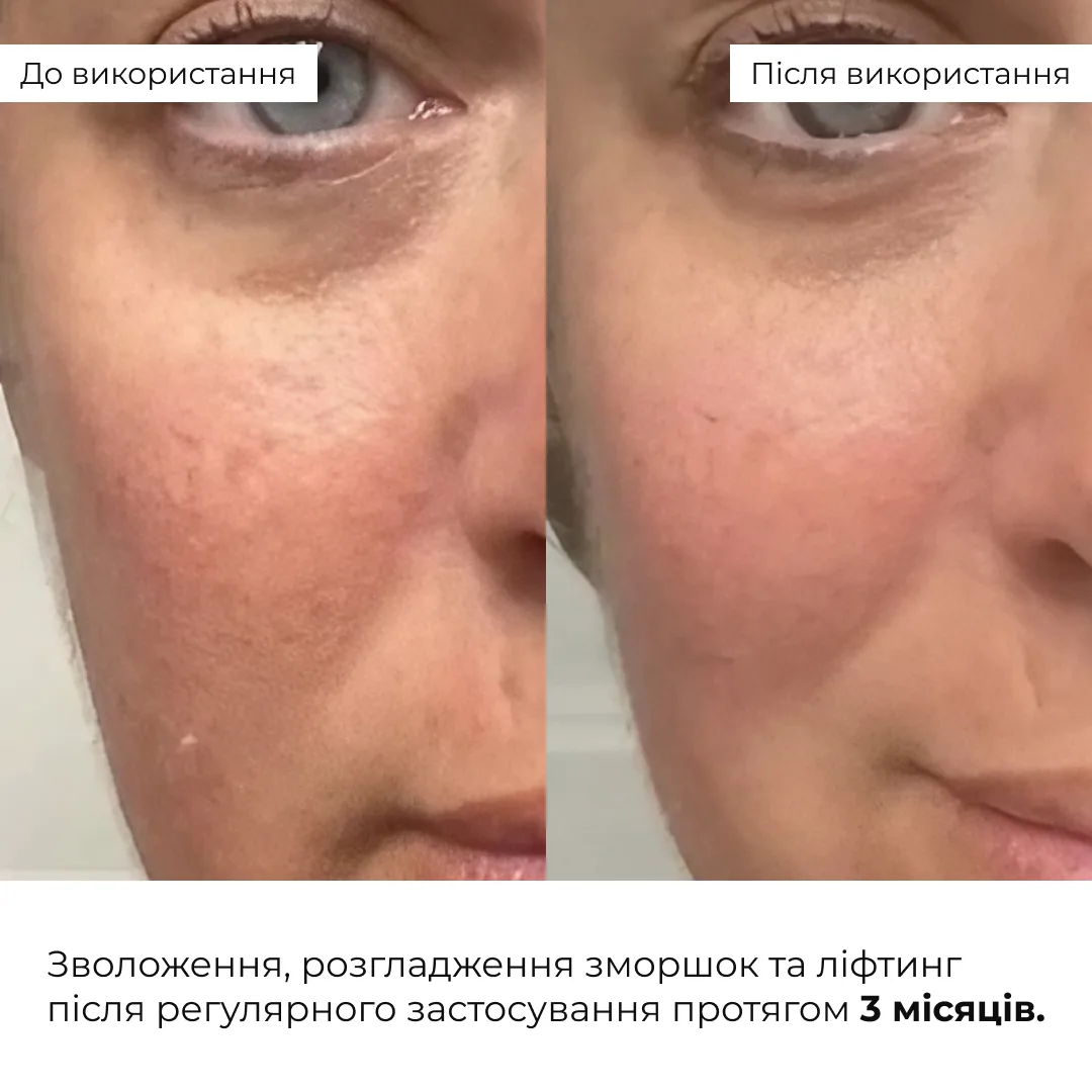 Антивіковий щоденний догляд за обличчям Hillary Daily Anti-Aging Care