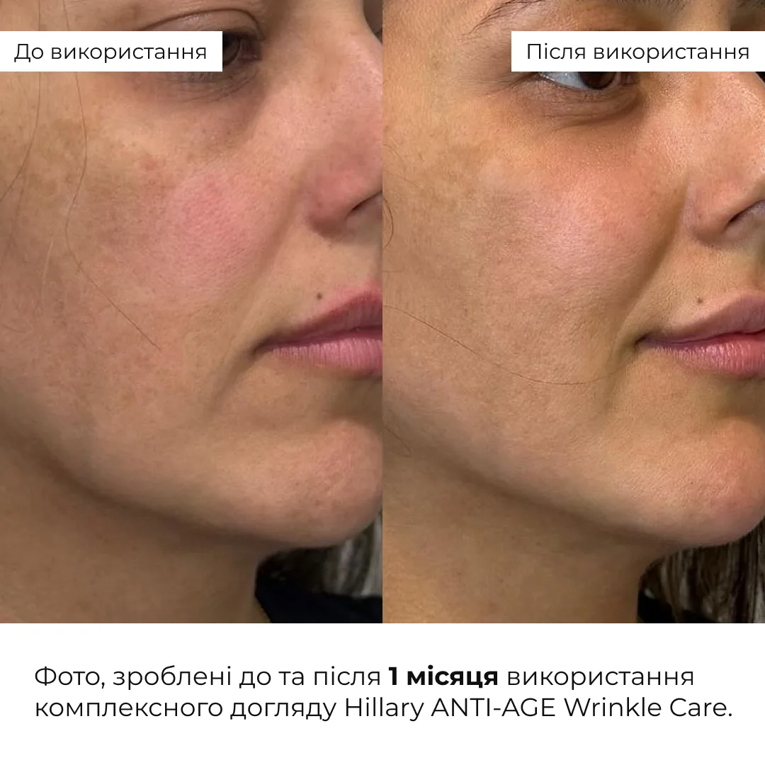 Комплексный уход Hillary ANTI-AGE Wrinkle Care антивозрастной крем для лица увлажнение питание