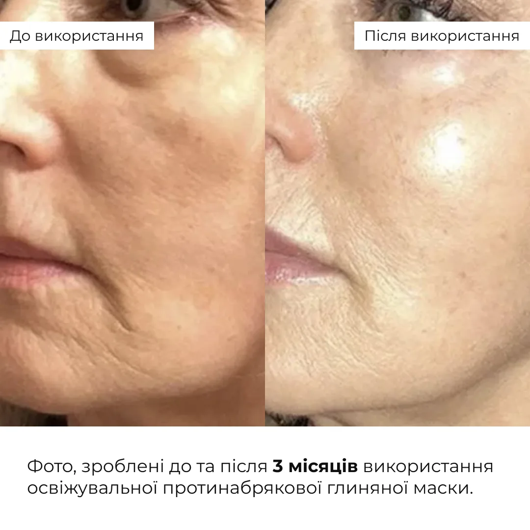Комплекс для боротьби з набряками і тьмяності шкіри Hillary Anti-Puffiness & Dullness Skin Care Complex