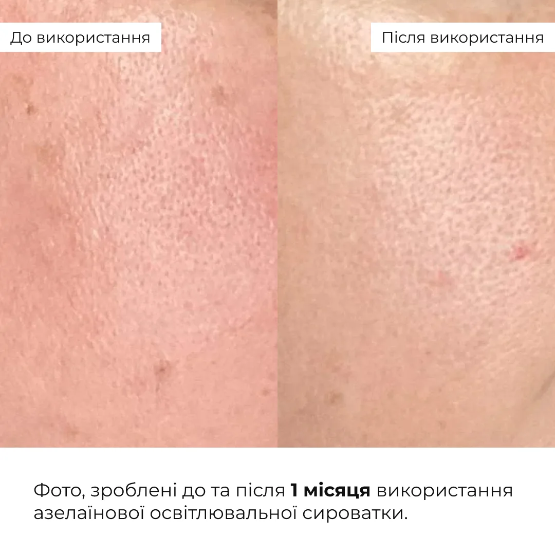 Комплекс для сияния и защиты кожи SPF30 Hillary для лица увлажняющий крем против пигментации.