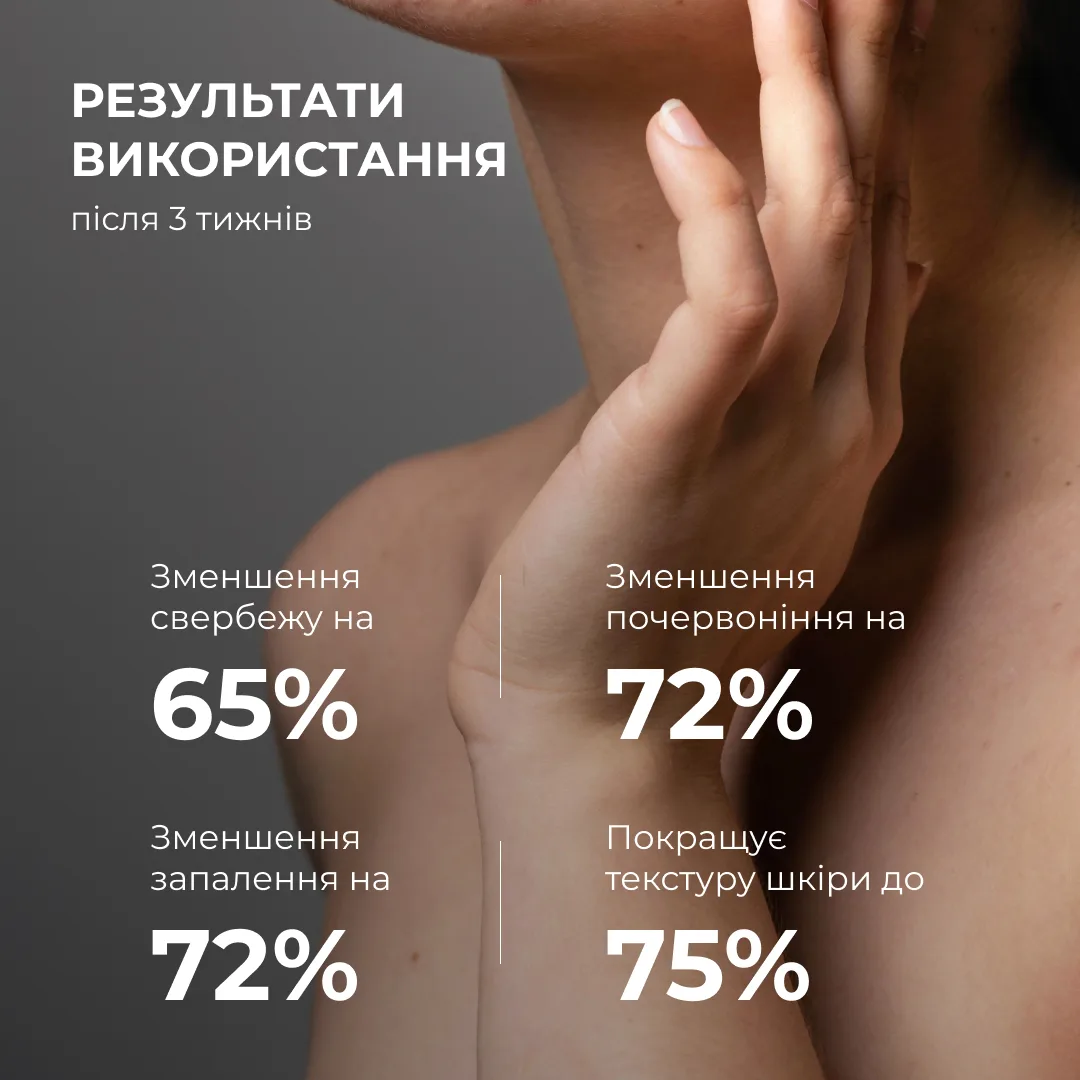 Лосьйон-детокс для проблемної шкіри з саліциловою кислотою Hillary Anti-Acne Salicylic Body Lotion, 150 мл