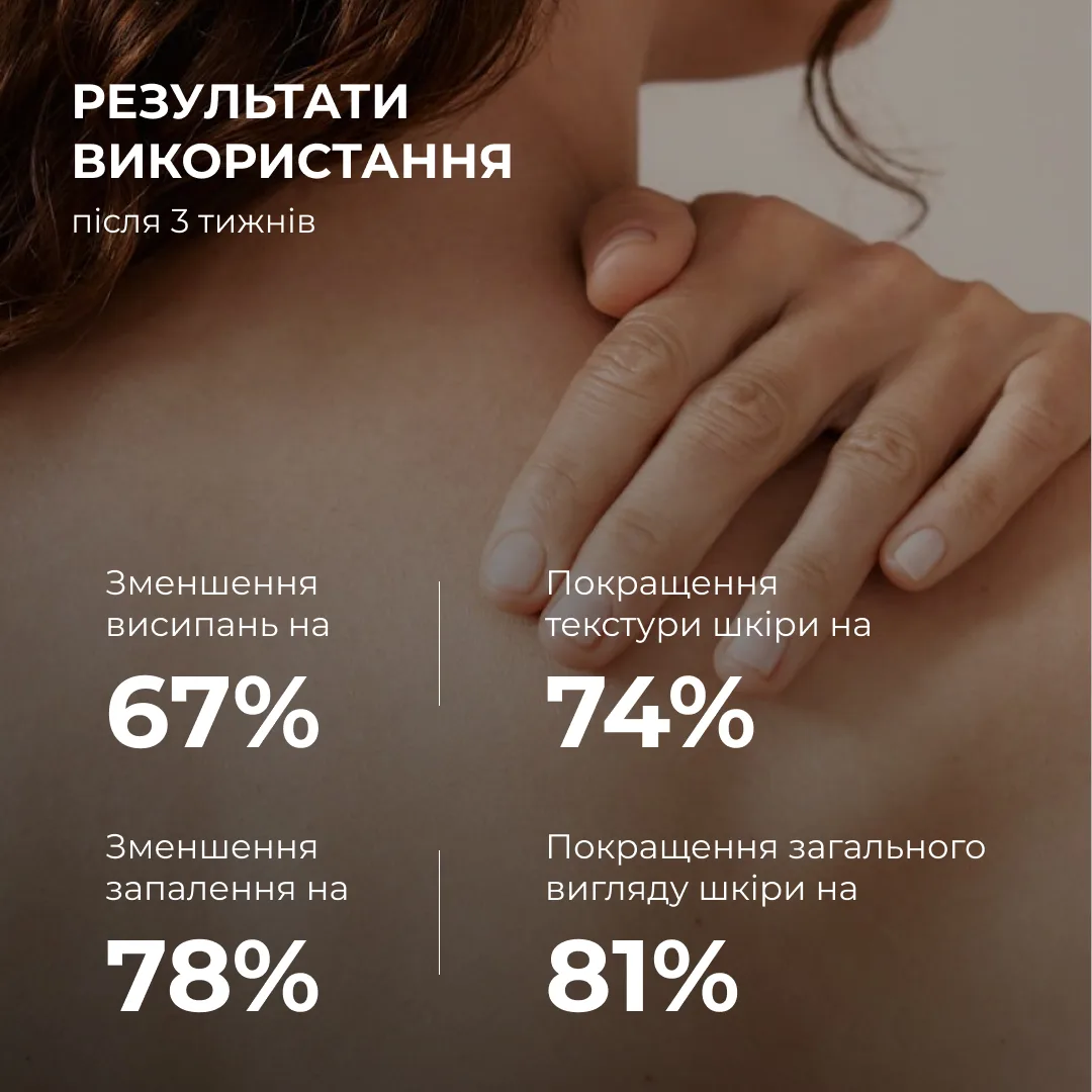 Комплекс потрійного удару проти акне на тілі з саліциловою кислотою Hillary Triple-Action Body Acne Control Co