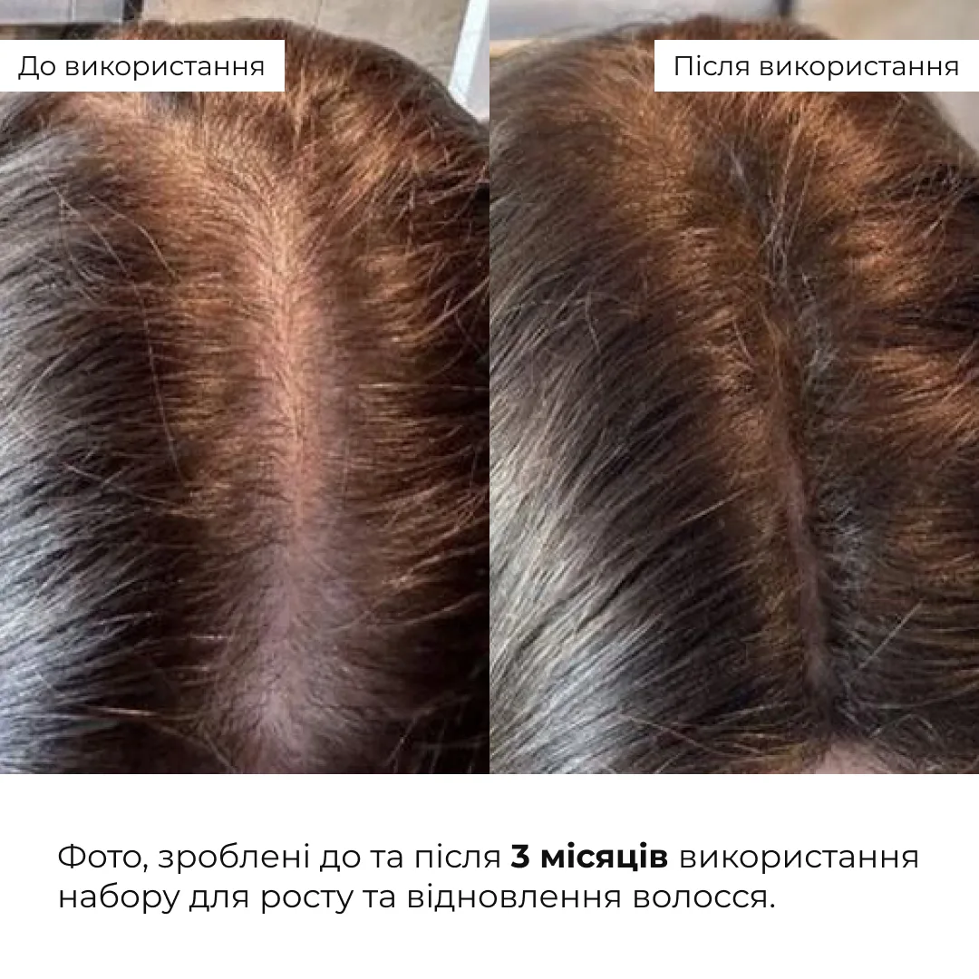 Шампунь для росту волосся Hillary Hop Cones & B5 Hair Growth Invigorating, 500 мл