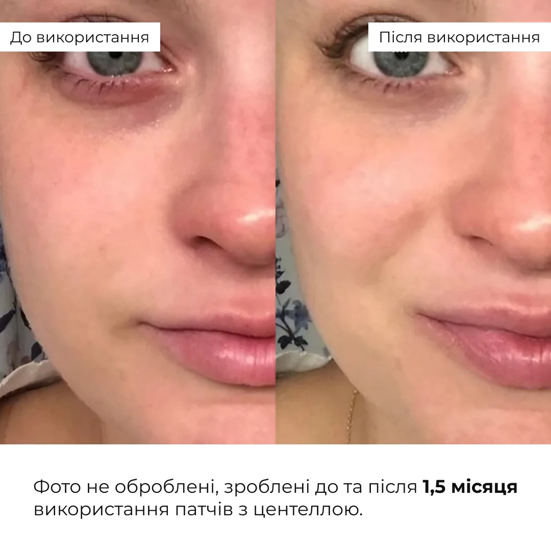 Набір для експрес-відновлення та зняття набряків Hillary Express Recovery & Anti-Puffiness Set