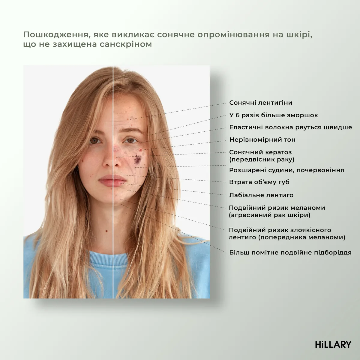 Набор для лица солнцезащитный и тонизирующий Hillary увлажняющий уход для кожи SPF30 защита и увлажнение.