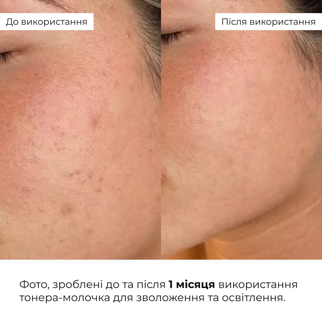 Набір для зволоження, очищення та освітлення шкіри Hillary Daily Hydration, Cleanse & Glow Set